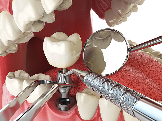 Best Broken or Cracked Tooth Emergency Dentist in Manson, IA